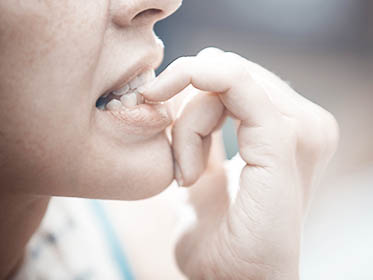 Tratamento para Onicofagia (unhas roidas)