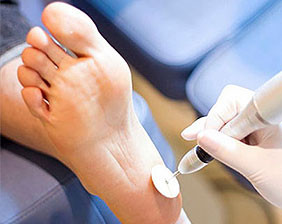 Tratamento para Rachadura no pé